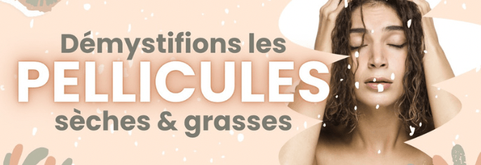 Démystifions les pellicules grasses et sèches ! - 53 Karat